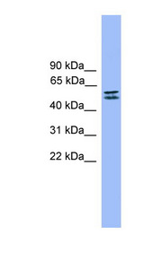 SPINT1 antibody LS-C116882 Western blot of Fetal Muscle lysate.