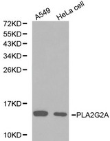 Western blot of PLA2G2A pAb in extracts from A549 and Hela cells.