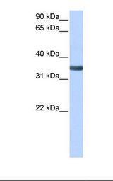 Fetal liver cell lysate. Antibody concentration: 0.5 ug/ml. Gel concentration: 12%.