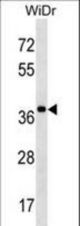 SPOP Antibody western blot of WiDr cell line lysates (35 ug/lane). The SPOP antibody detected the SPOP protein (arrow).