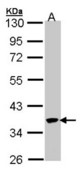 Sample (30 ug of whole cell lysate). A: 293T. 10% SDS PAGE. SPOP antibody diluted at 1:1000.
