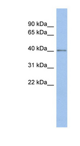 SPOPL antibody LS-C111265 Western blot of PANC1 cell lysate.