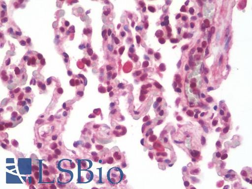 Anti-SPOPL antibody IHC staining of human lung. Immunohistochemistry of formalin-fixed, paraffin-embedded tissue after heat-induced antigen retrieval. Antibody LS-B10543 dilution 1:100.