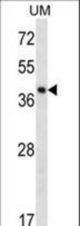 SPOPL Antibody western blot of uterus tumor cell line lysates (35 ug/lane). The SPOPL antibody detected the SPOPL protein (arrow).