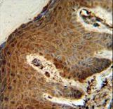 PTMS Antibody IHC of formalin-fixed and paraffin-embedded human skin followed by peroxidase-conjugated secondary antibody and DAB staining.