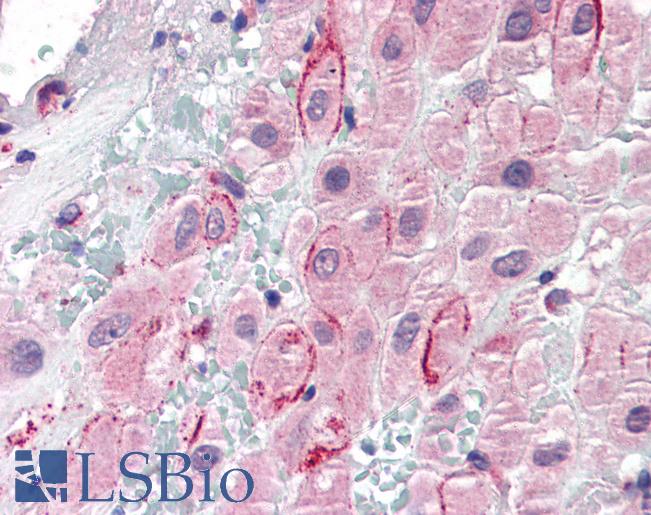 Anti-Osteopontin antibody IHC of human placenta. Immunohistochemistry of formalin-fixed, paraffin-embedded tissue after heat-induced antigen retrieval. Antibody LS-B2411 concentration 5 ug/ml.