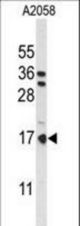 Western blot of PTMS Antibody in A2058 cell line lysates (35 ug/lane). PTMS (arrow) was detected using the purified antibody.
