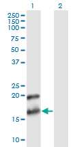Western blot of PTN expression in transfected 293T cell line by PTN monoclonal antibody (M02), clone 2E3.