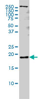 PTN monoclonal antibody (M01), clone 5C3 Western blot of PTN expression in HeLa NE.