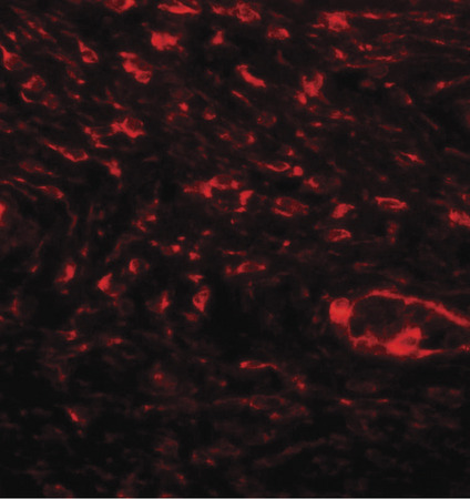 Immunofluorescence of SPP1 in human bladder tissue with SPP1 antibody at 20 ug/ml.
