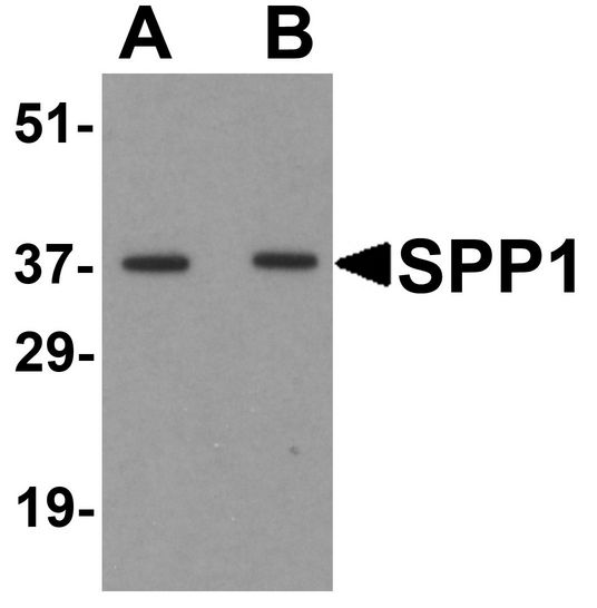 Western blot analysis of SPP1 in human bladder tissue lysate with SPP1 antibody at (A) 1 and (B) 2 ug/ml.