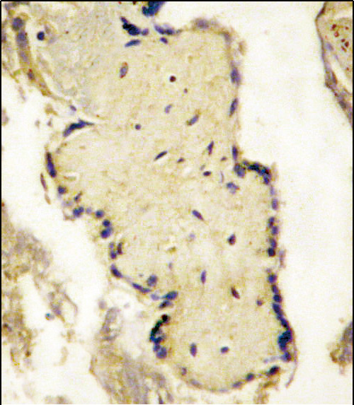 Formalin-fixed and paraffin-embedded placenta tissue reacted with SPPL2a Antibody , which was peroxidase-conjugated to the secondary antibody, followed by DAB staining. This data demonstrates the use of this antibody for immunohistochemistry; clinical relevance has not been evaluated.