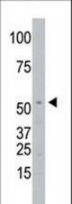 The anti-SPPL2a antibody is used in Western blot to detect SPPL2a in Jurkat cell lysate.