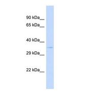 Western blot of Human 293T. SPPL2B antibody dilution 1.0 ug/ml.
