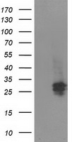 HEK293T cells were transfected with the pCMV6-ENTRY control (Left lane) or pCMV6-ENTRY SPR (Right lane) cDNA for 48 hrs and lysed. Equivalent amounts of cell lysates (5 ug per lane) were separated by SDS-PAGE and immunoblotted with anti-SPR.