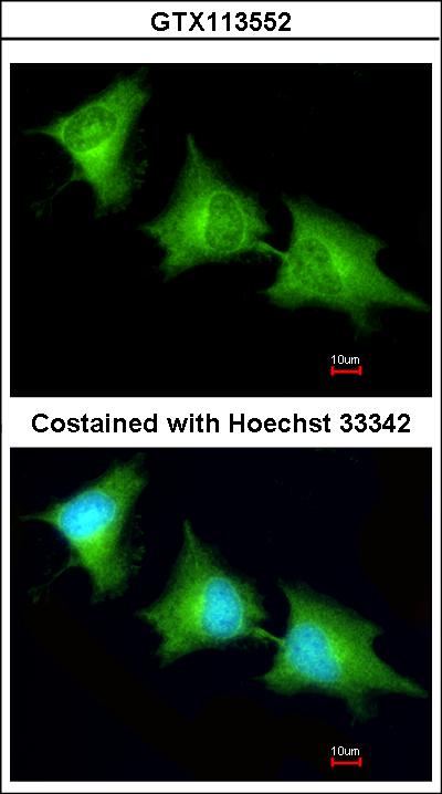Immunofluorescence of methanol-fixed HeLa using SPR antibody at 1:200 dilution.