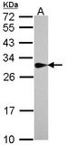 Sample (30 ug of whole cell lysate). A: A431 . 12% SDS PAGE. SPR antibody diluted at 1:1000.