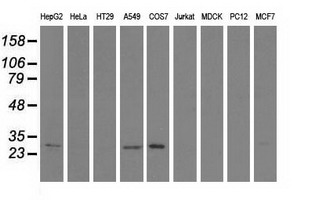Western blot of extracts (35 ug) from 9 different cell lines by using anti-SPR monoclonal antibody.