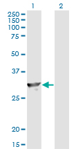 Western Blot analysis of SPR expression in transfected 293T cell line by SPR monoclonal antibody (M01), clone 4F2.Lane 1: SPR transfected lysate(28 KDa).Lane 2: Non-transfected lysate.