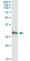 Immunoprecipitation of SPR transfected lysate using anti-SPR monoclonal antibody and Protein A Magnetic Bead, and immunoblotted with SPR rabbit polyclonal antibody.
