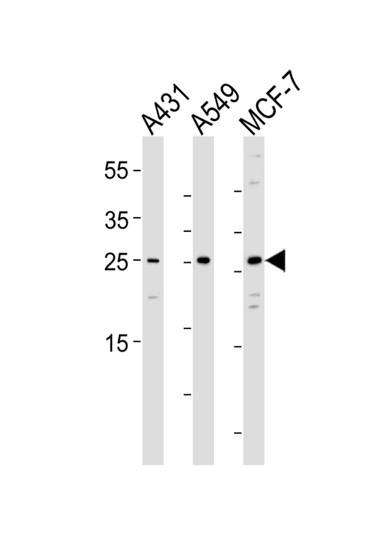 Western blot of lysates from A431, A549, MCF-7 cell line (from left to right) with SPR Antibody. Antibody was diluted at 1:1000 at each lane. A goat anti-rabbit IgG H&L (HRP) at 1:5000 dilution was used as the secondary antibody. Lysates at 35 ug per lane.