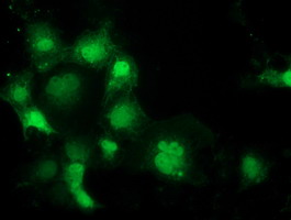 Anti-SPR mouse monoclonal antibody immunofluorescent staining of COS7 cells transiently transfected by pCMV6-ENTRY SPR.