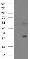 HEK293T cells were transfected with the pCMV6-ENTRY control (Left lane) or pCMV6-ENTRY SPR (Right lane) cDNA for 48 hrs and lysed. Equivalent amounts of cell lysates (5 ug per lane) were separated by SDS-PAGE and immunoblotted with anti-SPR.