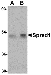 Western blot of Spred1 in mouse brain tissue lysate with Spred1 antibody at (A) 1 and (B) 2 ug/ml.