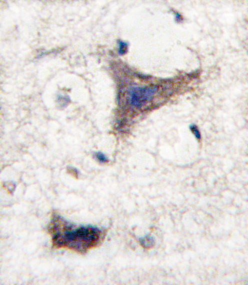 Formalin-fixed and paraffin-embedded human brain tissue reacted with SPRED1 antibody , which was peroxidase-conjugated to the secondary antibody, followed by DAB staining. This data demonstrates the use of this antibody for immunohistochemistry; clinical relevance has not been evaluated.