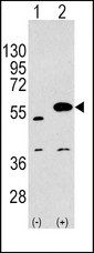 Western blot of SPRED1 Antibody polyclonal antibody(arrow). 293 cell lysates (2 ug/lane) either nontransfected (Lane 1) or transiently transfected with the SPRED1 gene (Lane 2) (Origene Technologies).
