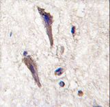 Formalin-fixed and paraffin-embedded human brain tissue reacted with SPRED1 antibody , which was peroxidase-conjugated to the secondary antibody, followed by DAB staining. This data demonstrates the use of this antibody for immunohistochemistry; clinical relevance has not been evaluated.