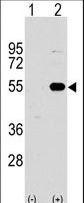 Western blot of SPRED1 (arrow) using rabbit polyclonal SPRED1 Antibody. 293 cell lysates (2 ug/lane) either nontransfected (Lane 1) or transiently transfected with the SPRED1 gene (Lane 2) (Origene Technologies).