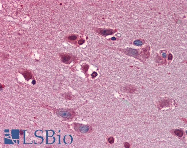 Anti-SPRED1 antibody IHC of human brain, cortex. Immunohistochemistry of formalin-fixed, paraffin-embedded tissue after heat-induced antigen retrieval. Antibody LS-B3845 concentration 5 ug/ml.