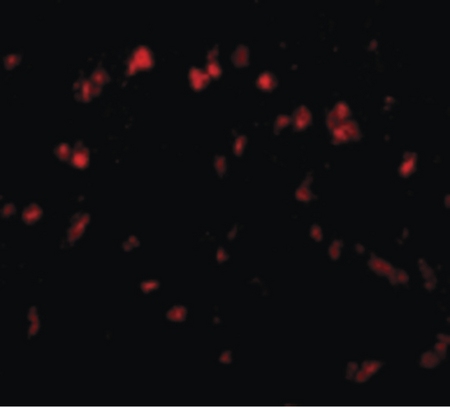 Immunofluorescence of Spred1 in Human Brain cells with Spred1 antibody at 20 ug/ml.