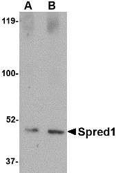 Western blot of Spred1 in human brain tissue lysate with Spred1 antibody at (A) 1 and (B) 2 ug/ml.