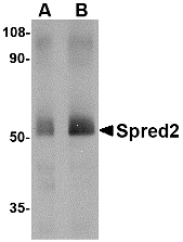 Western blot of Spred2 in human small intestine tissue lysate with Spred2 antibody at (A) 1 and (B) 2 ug/ml