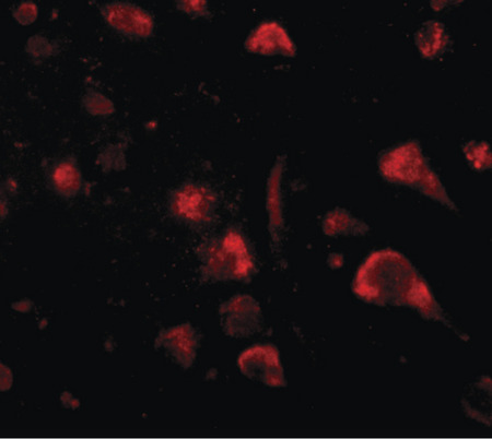 Immunofluorescence of spred3 in human brain tissue with spred3 antibody at 20 ug/ml.