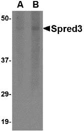 Western blot of Spred3 in human brain tissue lysate with Spred3 antibody at (A) 2 and (B) 4 ug/ml