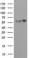 HEK293T cells were transfected with the pCMV6-ENTRY control (Left lane) or pCMV6-ENTRY TRIM9 (Right lane) cDNA for 48 hrs and lysed. Equivalent amounts of cell lysates (5 ug per lane) were separated by SDS-PAGE and immunoblotted with anti-TRIM9.