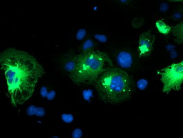 Anti-TRIM9 mouse monoclonal antibody immunofluorescent staining of COS7 cells transiently transfected by pCMV6-ENTRY TRIM9.