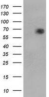 HEK293T cells were transfected with the pCMV6-ENTRY control (Left lane) or pCMV6-ENTRY TRIM9 (Right lane) cDNA for 48 hrs and lysed. Equivalent amounts of cell lysates (5 ug per lane) were separated by SDS-PAGE and immunoblotted with anti-TRIM9.
