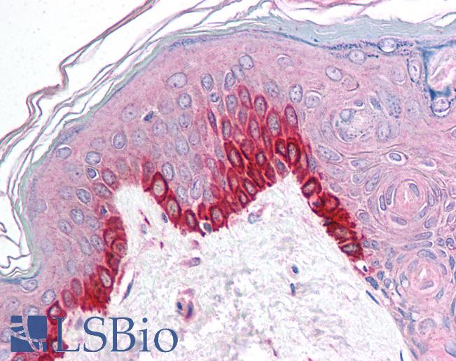 Anti-TRIM9 antibody IHC of human skin. Immunohistochemistry of formalin-fixed, paraffin-embedded tissue after heat-induced antigen retrieval. Antibody LS-B1111 concentration 5 ug/ml.