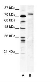 A: Marker, B: HepG2 Cell Lysate