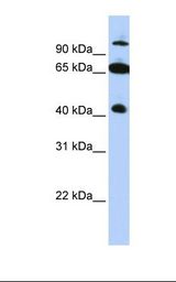 HepG2 cell lysate. Antibody concentration: 1.0 ug/ml. Gel concentration: 12%.