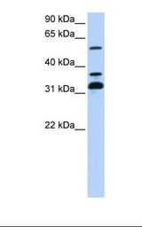 721_B cell lysate. Antibody concentration: 1.0 ug/ml. Gel concentration: 12%.