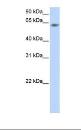 Fetal muscle lysate. Antibody concentration: 1.0 ug/ml. Gel concentration: 12%.