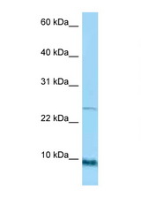 SPRR1A antibody LS-C146251 Western blot of HT1080 Cell lysate. Antibody concentration 1 ug/ml.