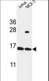 SPRR1A Antibody western blot of Jurkat,MCF-7 cell line lysates (35 ug/lane). The SPRR1A antibody detected the SPRR1A protein (arrow).
