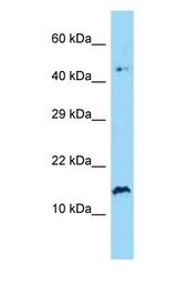 SPRR2A antibody Western Blot of Human Jurkat. Antibody dilution: 1 ug/ml.