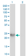Western blot of SPRR3 expression in transfected 293T cell line using antibody LS-B6151.